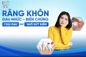 Có nên nhổ răng khôn không? Khi nào cần nhổ răng khôn?