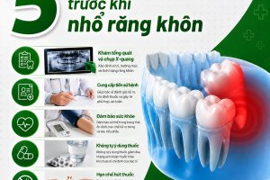 5 điều cần chú ý trước khi nhổ răng khôn để đảm bảo an toàn