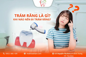 Trám Răng Là Gì? Khi Nào Cần Trám Răng? Quy Trình Và Lưu Ý Quan Trọng
