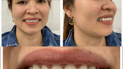Đính Đá Thẩm Mỹ Uy Tín Thủ Đức 