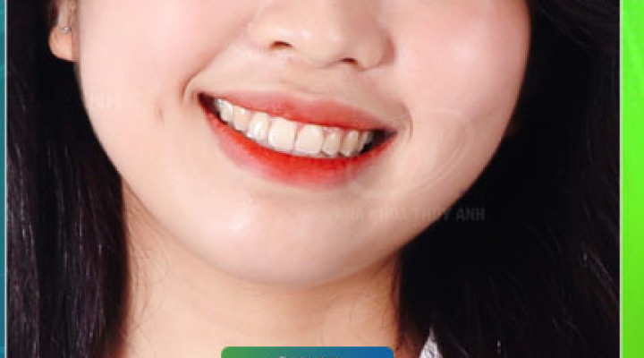 Bạn Ngọc Anh 28 tuổi