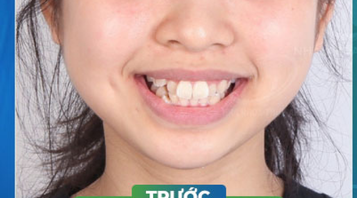 Bạn Ngọc Anh 28 tuổi