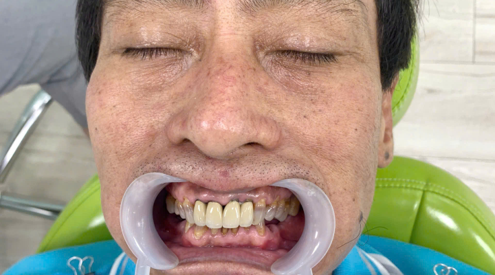 Chú Hải 65 tuổi
