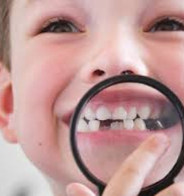 Trám răng sữa bằng vật liệu GC